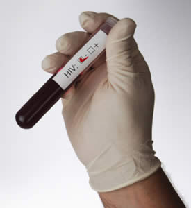 Disease control
